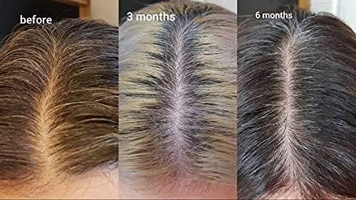 The Ordinary Multi-Peptide Hair Serum For Hair Density 60mL