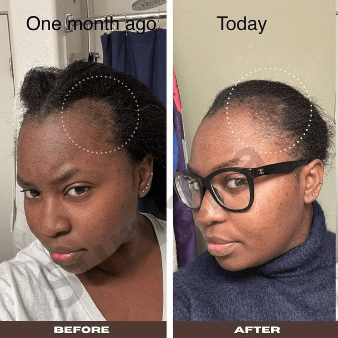 The Ordinary Multi-Peptide Hair Serum For Hair Density 60mL